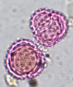 SeniorInnen News & Infos @ Senioren-Page.de | Foto: Ragweedpollen, hier unter dem Lichtmikroskop, verursachen gefhrliche Allergien: Die Ragweedpflanze breitet sich in Europa rasant aus.
